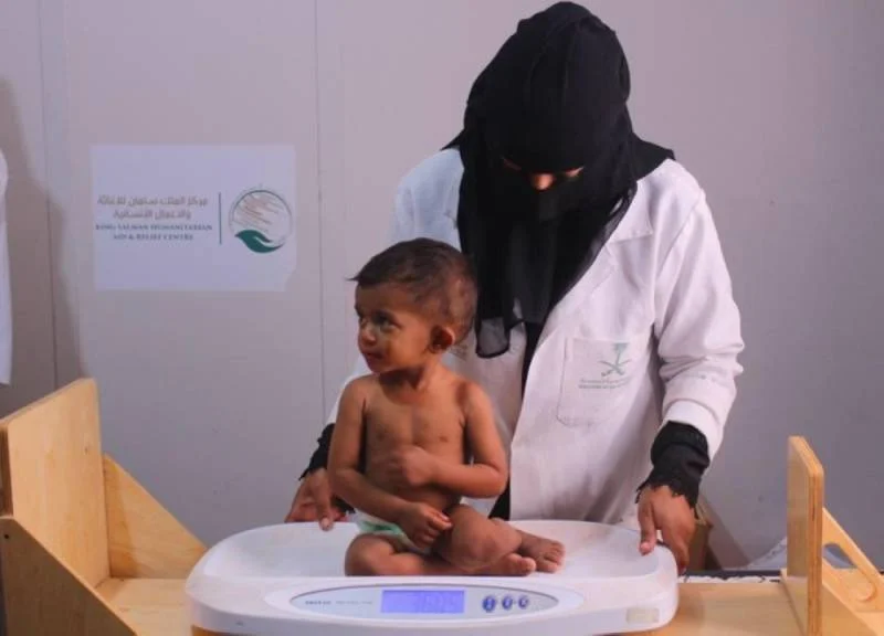"الصحة العالمية" تشيد بدعم "سلمان للإغاثة" لعلاج أطفال اليمن من سوء التغذية