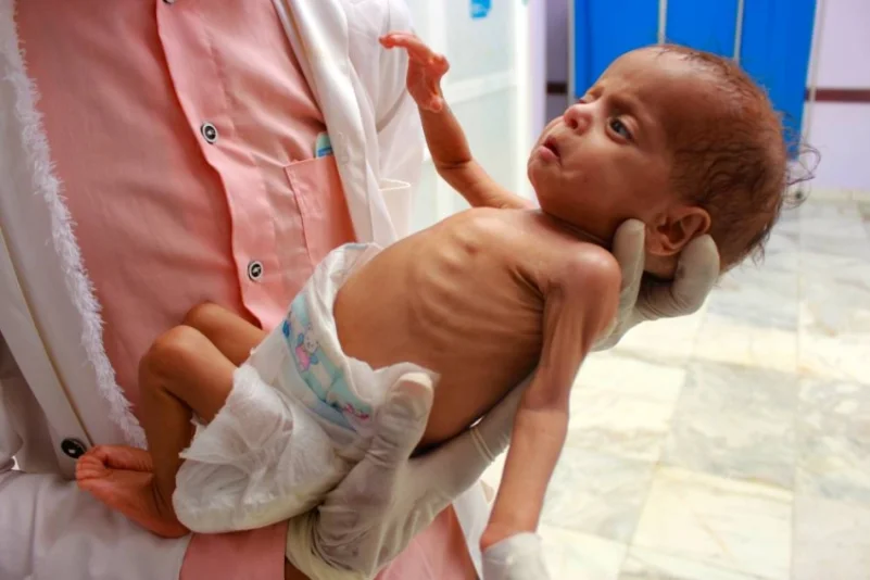 تفاقم معاناة أطفال اليمن بسبب تردي الاقتصاد وجرائم الحوثيين