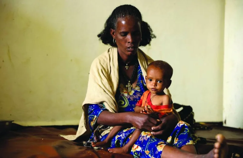 
Woletekiros Gebremikael, 28, holds her son, Letemedhin Woldebirhan, 2, severely malnourished due to food aid suspension from the UN World Food Programme and the US Agency for International Development at the Samre Hospital, in Samre, Tigray Region, Ethiopia. 