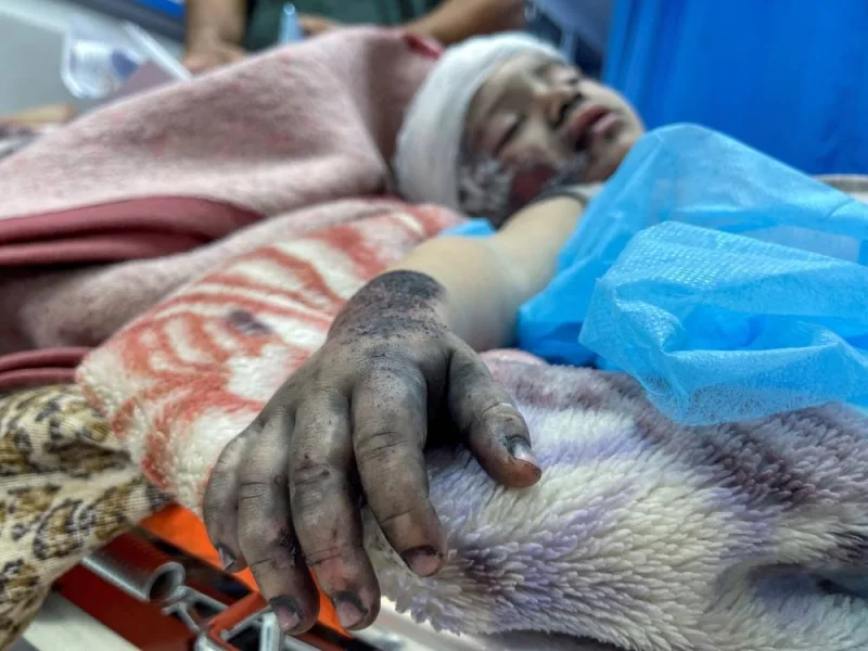 A Palestinian boy, who was wounded in an Israeli strike, lies on a bed at Shifa hospital in Gaza City, Sunday. REUTERS