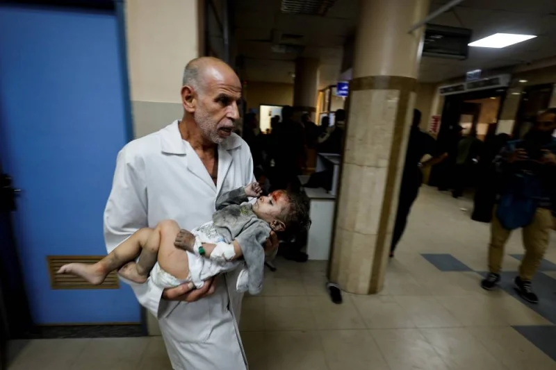 A Palestinian child wounded in an Israeli strike is assisted at Nasser hospital in Khan Younis in the southern Gaza Strip, on Saturday. REUTERS