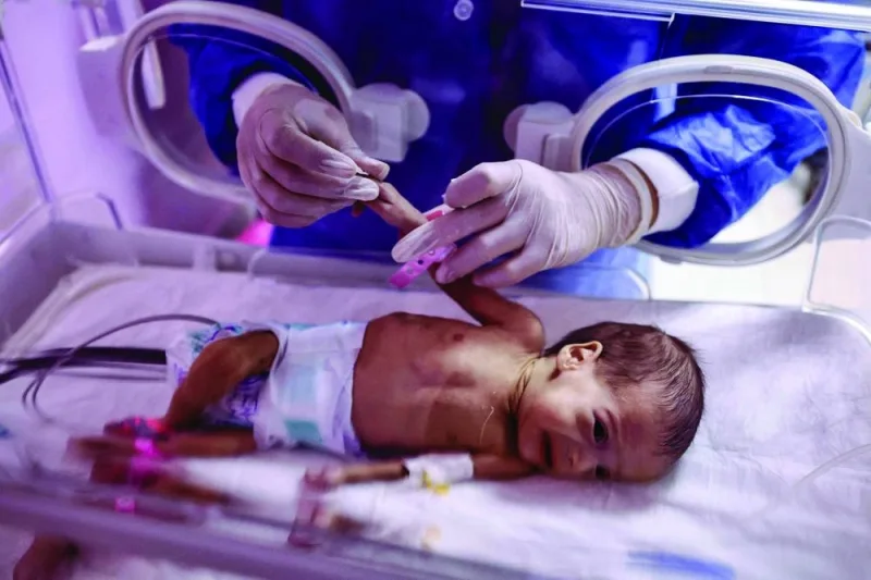 
A medic provides care to a premature Palestinian baby, recently evacuated from the Gaza Strip, at a hospital in al-Aris in the North Sinai Governorate of Egypt yesterday. Twenty-nine premature babies arrived in Egypt on November 20, after they were evacuated from Gaza’s Al-Shifa hospital which has become a focal point of Israel’s war. (AFP) 