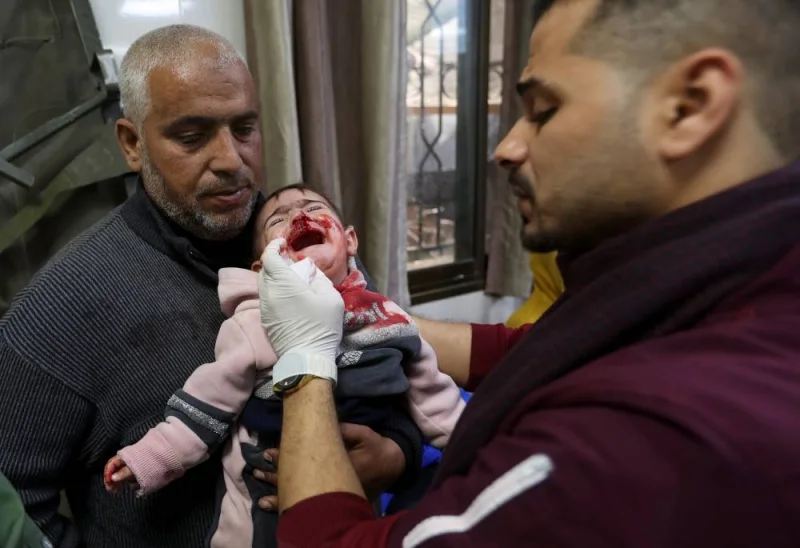 A Palestinian child wounded in Israeli strikes is attended to in Nasser hospital, in Khan Younis in the southern Gaza Strip, on Monday. REUTERS