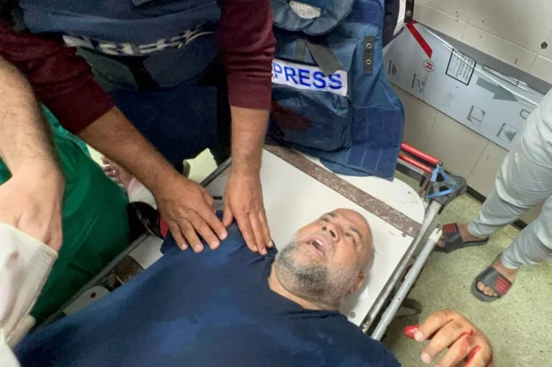 Veteran Al-Jazeera correspondent Wael Al-Dahdouh receives medical care after he was injured while covering ongoing Israeli aggression in Gaza, at Nasser hospital in Khan Yunis in the southern Gaza Strip on Friday. AFP