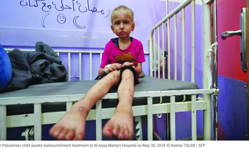 
A Palestinian child awaits malnourishment treatment at Al-Aqsa Martyrs Hospital. 