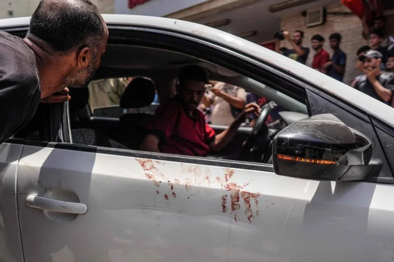 A bloody handprint marks a white car at the al-Aqsa Martyrs Hospital in Deir al-Balah, in the central Gaza Strip, following the Israeli bombardment of a residential apartment in Deir al-Balah on Saturday. AFP