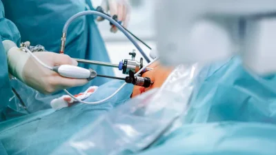 إجراء جراحة نادرة لتخليص أحد الأشخاص من السمنة