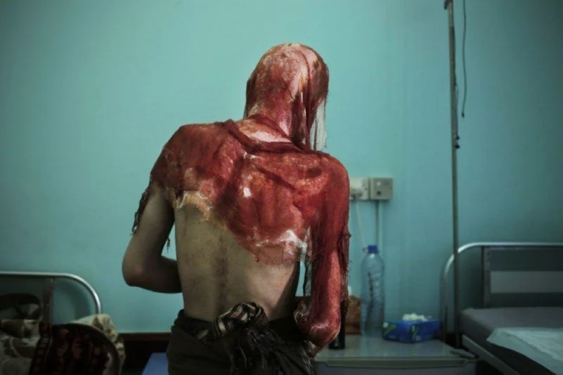 شهادات مروعة وفظائع تعذيب مرعبة بسجون الحوثي