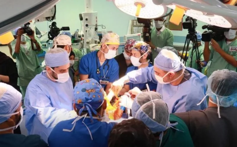 ‏‎الفريق الطبي ينجح بفصل الأجهزة الملتصقة للتوأم السيامي الليبي