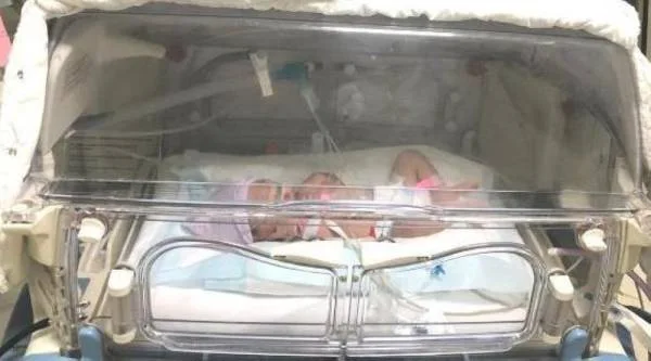 المدينة المنورة : ولادة ناجحة لمريضة على رئة اصطناعية لمصابة بكورونا