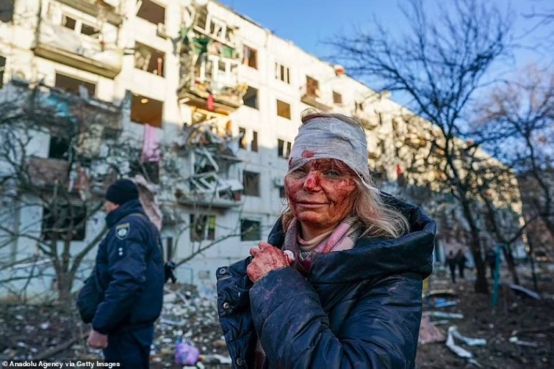 شاهد : معلمة أوكرانية تنجو بأعجوبة من هجوم صاروخي على منزلها وتتعهد بحماية وطنها رغم إصابتها