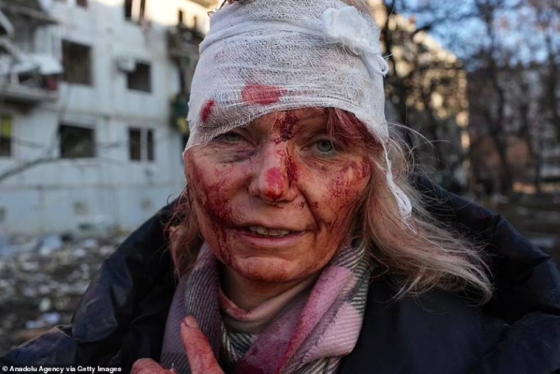 شاهد : معلمة أوكرانية تنجو بأعجوبة من هجوم صاروخي على منزلها وتتعهد بحماية وطنها رغم إصابتها