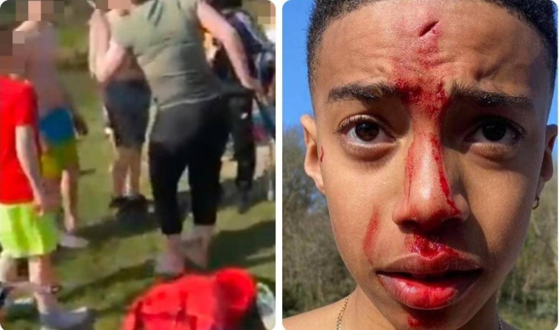 شاهد.. امرأة أمريكية تضرب طفل وتشج رأسه بمجداف بسبب بشرته السوداء