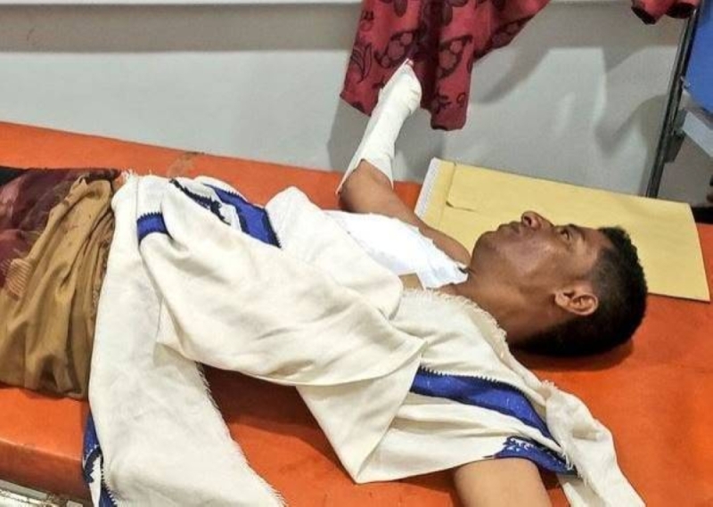 شاهد بالصور: ميليشيا الحوثي تقتل طفلًا عمره 5 سنوات  بقذيفة مباشرة.. وهذا ما حدث لوالديه