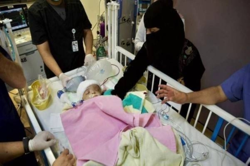 بعد ساعات من فصلهما.. وفاة أحد التوأم السيامي اليمني "يوسف وياسين" والفريق الطبي يكشف عن السبب