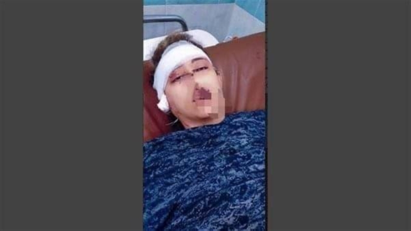 شاهد: مصري يقطع أذن زوجته ويسدد لها 20 طعنة .. والسبب صادم!