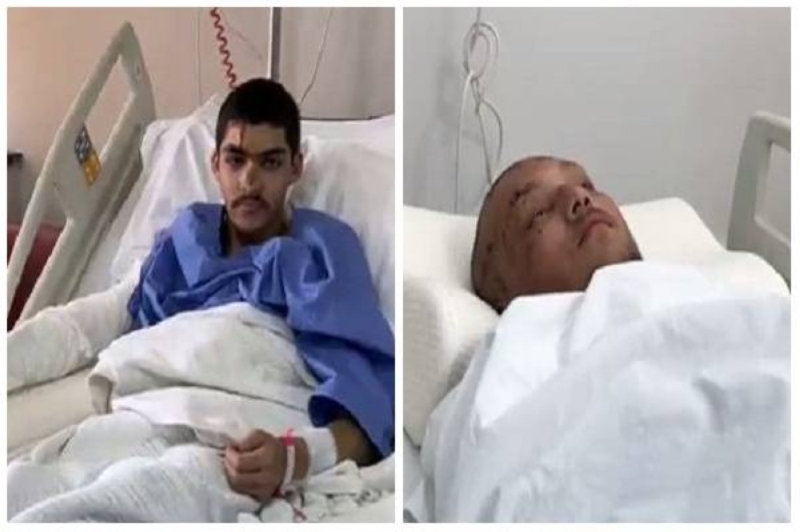 شاهد.. أول صور للمواطنين المصابين  في حادث "ريزا التركية" بعد وصولهم إلى مستشفى الملك فهد بالمدينة