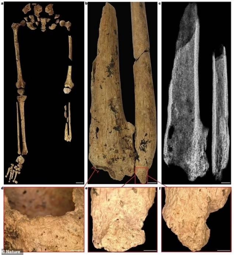 العثور على  بقايا عظام شاب بترت قدمه قبل 31 ألف عام.. والكشف عن عمره قبل وبعد الجراحة