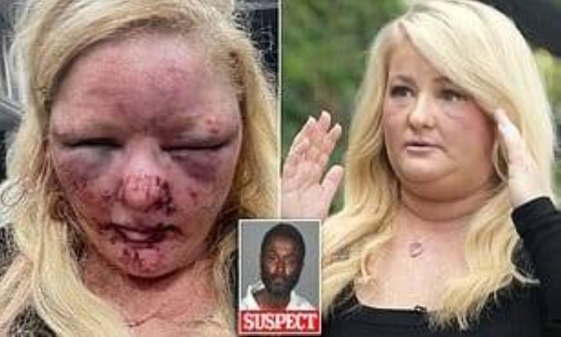 "أثناء خروجها لتمشية كلابها"...  اغتصاب أمريكية وتهشيم وجهها في كاليفورنيا - فيديو وصور