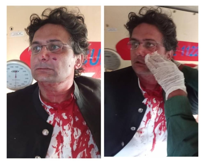 شاهد.. لحظة إصابة السيناتور فيصل جاويد والدماء تغطي ملابسه أثناء محاولة اغتيال عمران خان