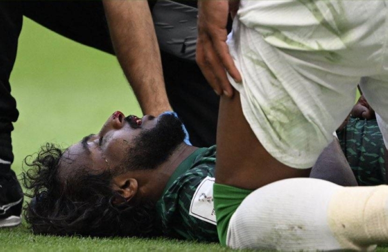 شاهد: أول صورة  لحظة اصطدام ركبة العويس في وجه اللاعب ياسر الشهراني