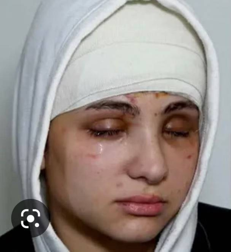 بالفيديو: تفاصيل تعرض "بلوغر" مصرية لهجوم مسلح برفقة خطيبها .. وإصابتها برصاصة أفقدتها البصر
