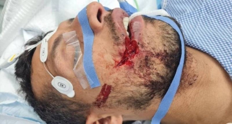 شاهد.. أول صورة للإصابة المروعة التي تعرض لها لاعب الاتحاد طارق حامد أمام الصفاقسي التونسي