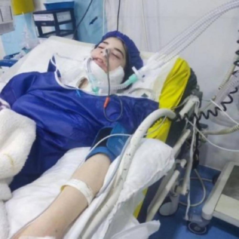 والد المراهقة الإيرانية التي تعرضت للضرب من شرطة الأخلاق بسبب الحجاب يكشف مفاجأة بشأن حالتها الصحية