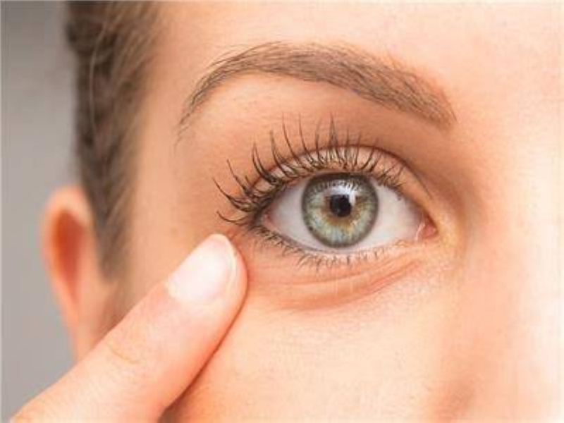 الكشف عن 3 علامات تحذيرية تظهر حول العينين تشير إلى ارتفاع الكوليسترول