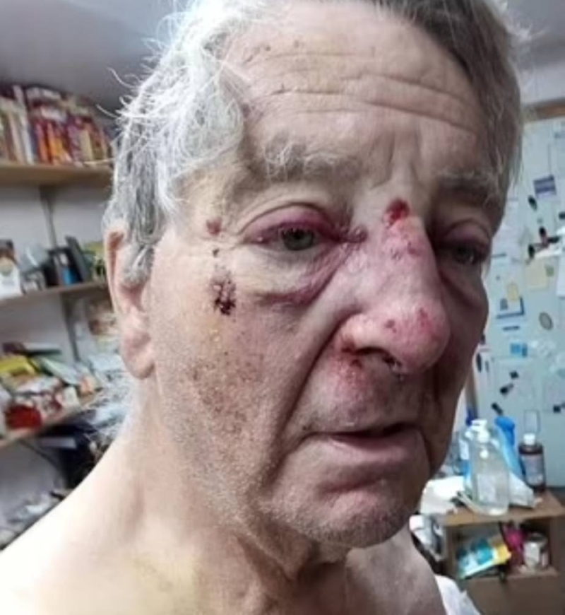 وجهه تلطخ بالدماء.. شاهد: الشرطة الأمريكية تعتدي بعنف على مسن أمام زوجته لسبب غريب