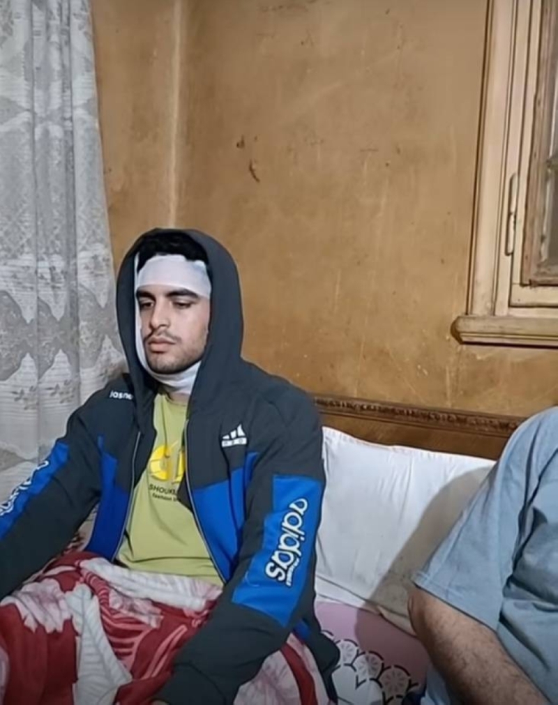طالب مصري يشوه وجه زميله الجامعي بآلة حادة ويصيبه بـ115 غرزة..لسبب غريب!
