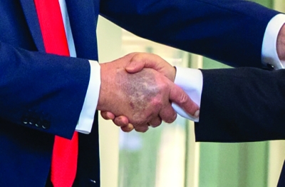 كدمة على يد ترامب