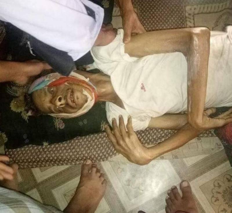 الاتحاد الدولي للصحفيين : ندين الجريمة التي أودت بحياة صحفي يمني بسجون الحوثيين