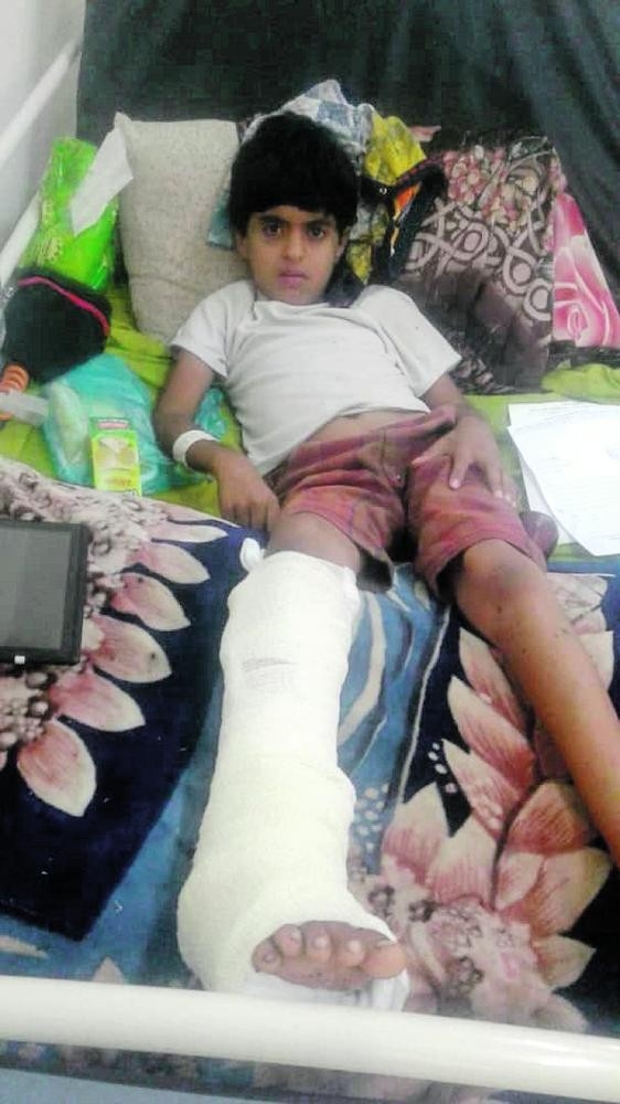 «حصاد الأسلحة».. جرائم الحوثي ترويها دماء أطفال اليمن