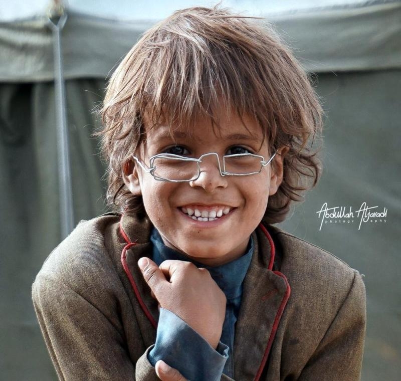 «نظارة» طفل يمني تباع بـ 2.5 مليون ريال