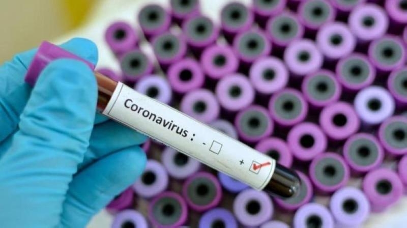 196 إصابة جديدة بفيروس كورونا في بلغاريا