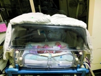 ولادة ناجحة على رئة اصطناعية لمصابة بكورونا في المدينة المنورة