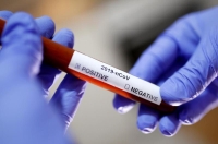 ليبيا.. 355 حالة إصابة جديدة بفيروس كورونا