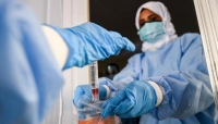 427 إصابة جديدة بفيروس كورونا في الإمارات