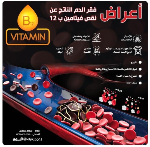 أعراض فقر الدم الناتج عن نقص فيتامين ب 12