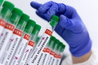 الصحة العالمية: فعالية التطعيم السابق ضد جدري القرود تصل إلى 85%