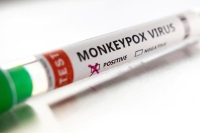 تحليل اختبار عدوى فيروس جدري القرود - رويترز 