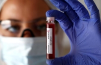 هل يمكن توقع المرض بمعرفة فصيلة الدم؟