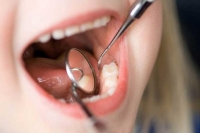 يجب زيارة طبيب الأسنان من وقت لآخر لتجنب مخاطر التسوس