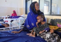 يونيسف: إصابة طفل كل دقيقة بسوء التغذية في الصومال