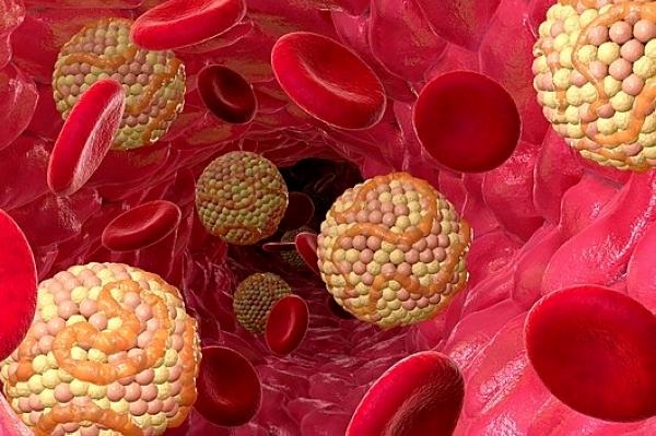 يوجد نوعان من الكوليسترول في الدم - مشاع إبداعي