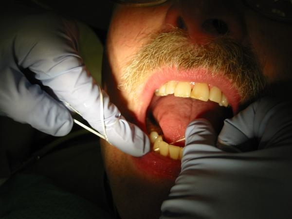 المتابعة الدورية للكشف على الأسنان ضرورية لمرضى السكري - مشاع إبداعي