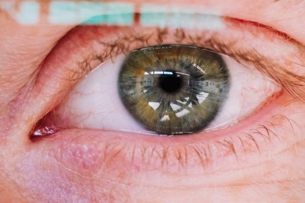 تدلي جفن العين يؤثر على الرؤية - مشاع إبداعي