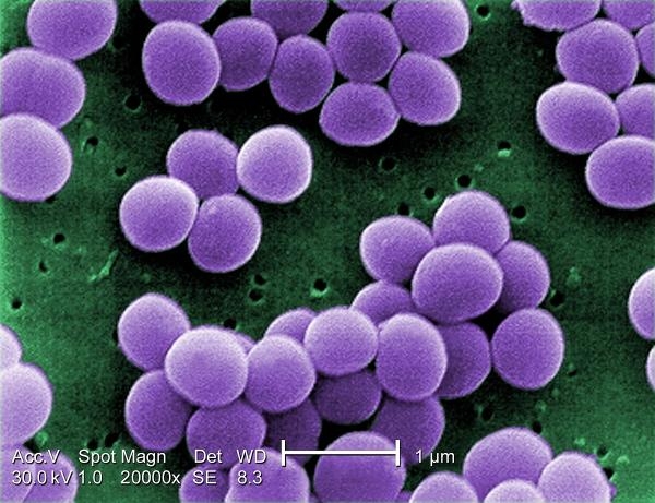 لقطة ميكروسكوبية لبكتيريا المكورات العنقودية - مشاع إبداعي