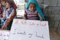 طفلة يمنية ضحية للإرهاب الحوثي تطالب بالقصاص من الميليشيا - اليوم